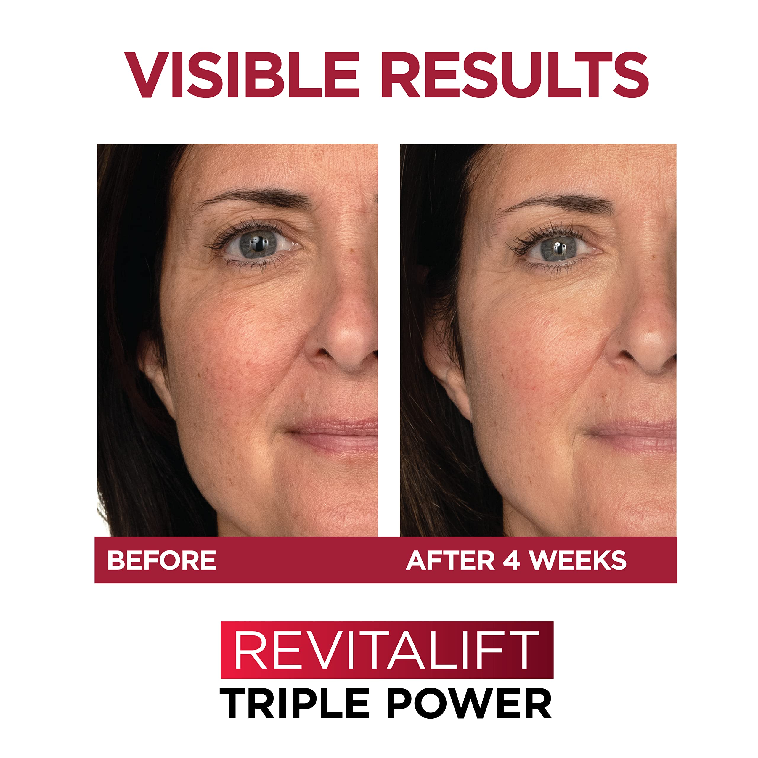 643-l-oreal-paris-revitalift-1.5-pure-hyaluronic-acid-face-serum-triple-power-anti-aging-face-moisturizer-1-kit-6.jpg L'Oreal Paris Revitalift 1.5% Pure Hyaluronic Acid Face Serum + Triple Power Anti-Aging Face Moisturizer, 1 kit